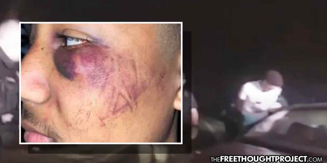 Cop Arrested After Beating, Leaving Boot Marks on Face of Teen Over a Speeding Ticket