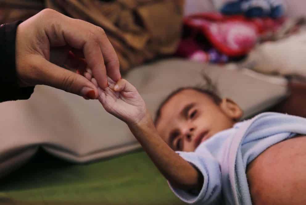 yemen child hunger hand sh ps 181121 hpembed 3x2 992